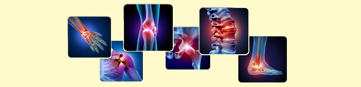 Arthritis Panel