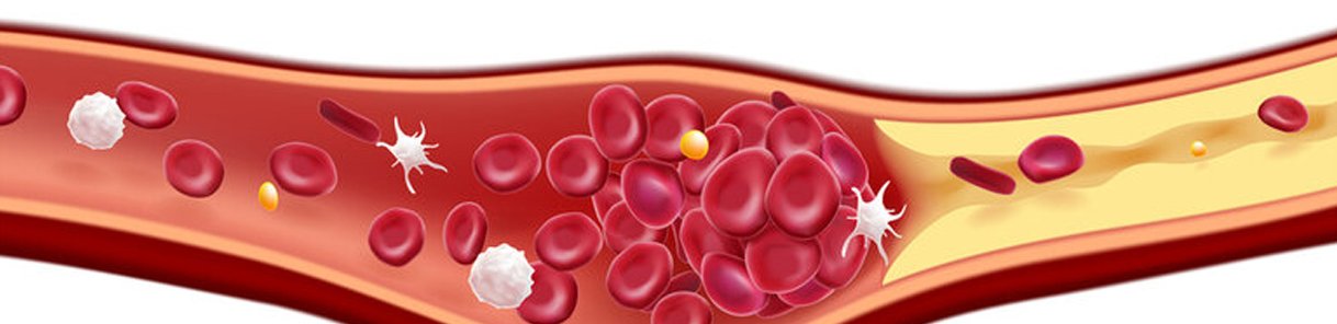 Thrombophillia & Thrombosis Panel